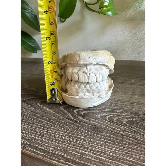 Vintage Dental Teeth Mold Cast – Upper & Lower Set - Picture 2 of 11
